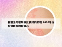 目前治疗银屑病比较好的药物 2020年治疗银屑病的特效药