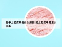 腿子上起皮癣是什么原因 腿上起皮子是怎么回事