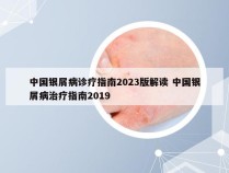 中国银屑病诊疗指南2023版解读 中国银屑病治疗指南2019