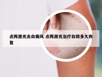 点阵激光去白癜风 点阵激光治疗白斑多久恢复