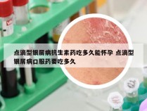 点滴型银屑病抗生素药吃多久能怀孕 点滴型银屑病口服药要吃多久