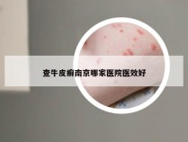 查牛皮癣南京哪家医院医效好