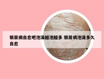 银屑病自愈吧泡澡越泡越多 银屑病泡澡多久自愈