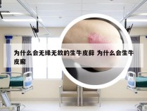 为什么会无缘无故的生牛皮藓 为什么会生牛皮廨