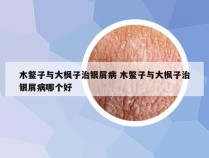 木鳖子与大枫子治银屑病 木鳖子与大枫子治银屑病哪个好