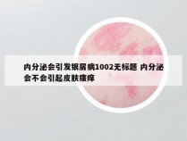 内分泌会引发银屑病1002无标题 内分泌会不会引起皮肤瘙痒