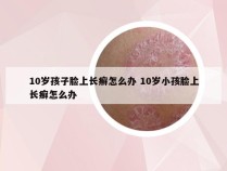 10岁孩子脸上长癣怎么办 10岁小孩脸上长癣怎么办