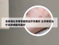 皮肤病北京哪家医院治疗效果好 北京哪家治疗皮肤病医院最好