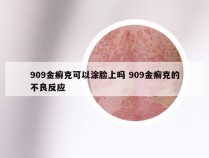 909金癣克可以涂脸上吗 909金癣克的不良反应