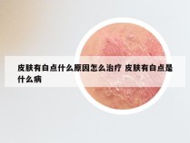 皮肤有白点什么原因怎么治疗 皮肤有白点是什么病