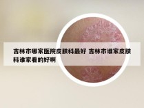 吉林市哪家医院皮肤科最好 吉林市谁家皮肤科谁家看的好啊