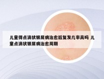 儿童得点滴状银屑病治愈后复发几率高吗 儿童点滴状银屑病治愈周期