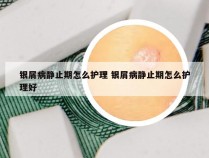 银屑病静止期怎么护理 银屑病静止期怎么护理好