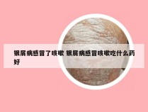 银屑病感冒了咳嗽 银屑病感冒咳嗽吃什么药好