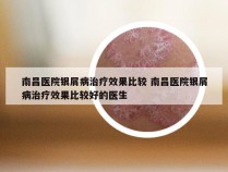 南昌医院银屑病治疗效果比较 南昌医院银屑病治疗效果比较好的医生