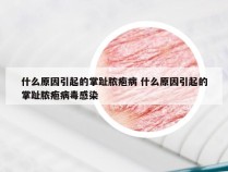 什么原因引起的掌趾脓疱病 什么原因引起的掌趾脓疱病毒感染