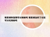 银屑病恢复期可以辣椒吗 银屑病治好了以后可以吃辣椒吗