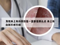 发现身上有白斑但是一直都是那么点 身上有白斑不疼不痒