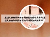 重组人表皮生长因子凝胶能治疗牛皮癣吗 重组人表皮生长因子凝胶可以修复皮肤屏障