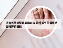 河南关节病型银屑病方法 治疗关节型银屑病比较好的医院