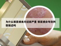 为什么银屑病来月经就严重 银屑病会导致例假推迟吗