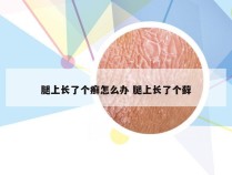 腿上长了个癣怎么办 腿上长了个藓