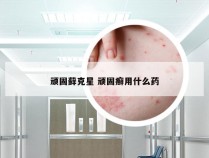 顽固藓克星 顽固癣用什么药