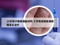 10岁孩子银屑病能好吗 十岁男孩银屑病初期怎么治疗