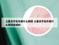 儿童关节处长癣什么原因 儿童关节处长癣什么原因造成的