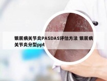 银屑病关节炎PASDAS评估方法 银屑病关节炎分型ppt