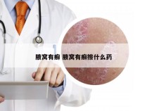 腋窝有癣 腋窝有癣擦什么药