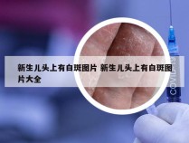 新生儿头上有白斑图片 新生儿头上有白斑图片大全