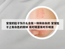 宝宝的肚子为什么会有一块块白白的 宝宝肚子上有白色的斑块 有时明显有时不明显