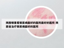 陕西哪里看银屑病最好的医院最好的医院 陕西省治疗银屑病最好的医院