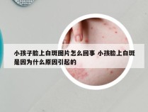 小孩子脸上白斑图片怎么回事 小孩脸上白斑是因为什么原因引起的