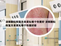 消银颗粒和复方青黛丸哪个效果好 消银颗粒和复方青黛丸哪个效果好些