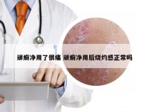 顽癣净用了很痛 顽癣净用后烧灼感正常吗