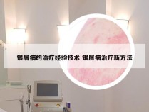 银屑病的治疗经验技术 银屑病治疗新方法