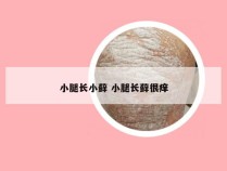 小腿长小藓 小腿长藓很痒