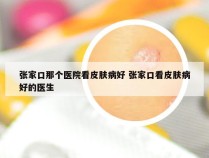 张家口那个医院看皮肤病好 张家口看皮肤病好的医生