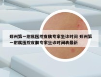 郑州第一附属医院皮肤专家坐诊时间 郑州第一附属医院皮肤专家坐诊时间表最新