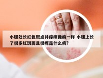 小腿处长红色斑点并痒痒像癣一样 小腿上长了很多红斑而且很痒是什么病?