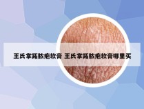 王氏掌跖脓疱软膏 王氏掌跖脓疱软膏哪里买