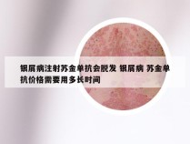 银屑病注射苏金单抗会脱发 银屑病 苏金单抗价格需要用多长时间