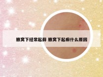 腋窝下经常起藓 腋窝下起癣什么原因