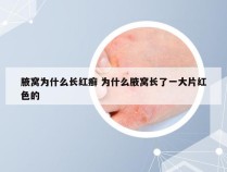 腋窝为什么长红癣 为什么腋窝长了一大片红色的