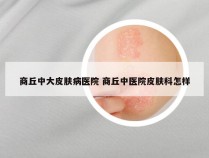 商丘中大皮肤病医院 商丘中医院皮肤科怎样