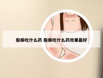 股癣吃什么药 股癣吃什么药效果最好