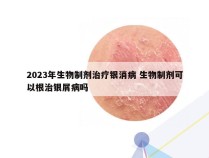 2023年生物制剂治疗银消病 生物制剂可以根治银屑病吗