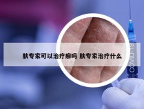 肤专家可以治疗癣吗 肤专家治疗什么